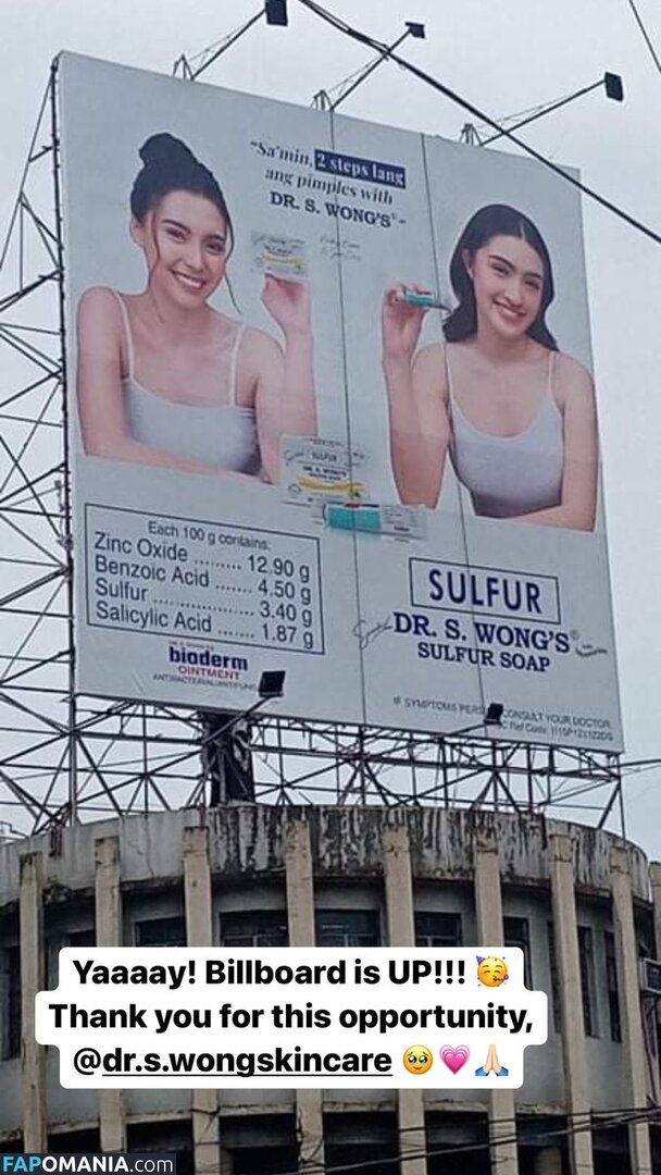 Analyn Barro Nudo OnlyFans  Foto trapelata #10